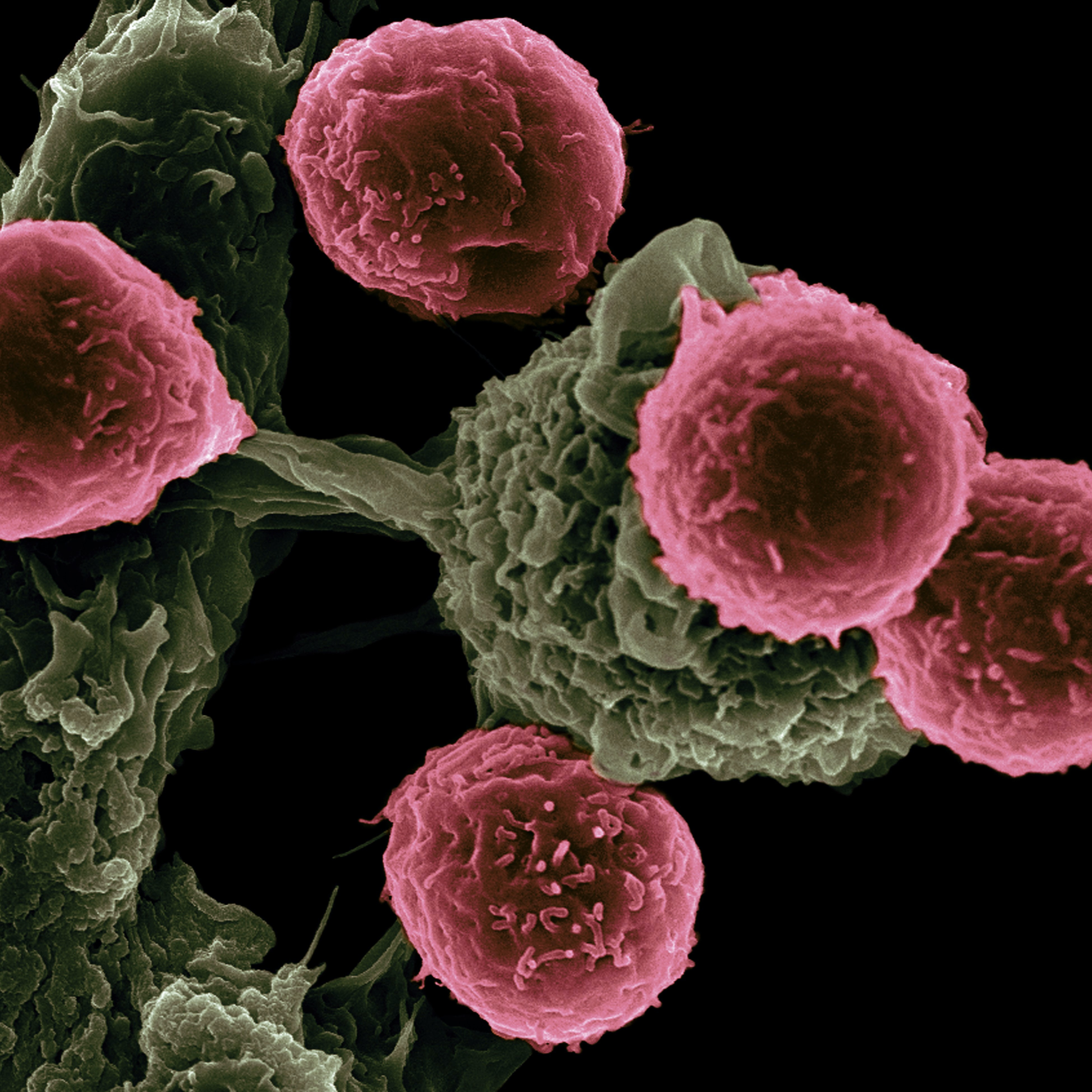 Ilustrasi kanker. (Dok. National Cancer Institute dari Unsplash)